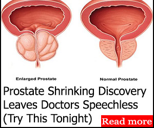 Shrink Prostates Gland